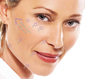 Juvederm